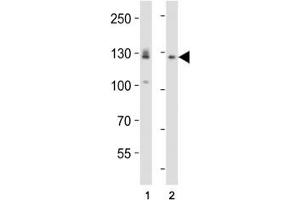 Western blot analysis of lysate from (1) A431 and (2) U-87 MG cell line using EPHA2 antibody diluted at 1:1000. (EPH Receptor A2 anticorps  (AA 518-552))