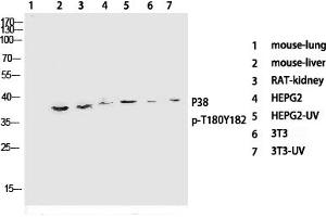 Western Blotting (WB) image for anti-Mitogen-Activated Protein Kinase 14 (MAPK14) (pThr180), (pTyr182) antibody (ABIN5955628) (MAPK14 anticorps  (pThr180, pTyr182))