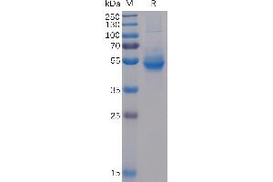 Human ICOS Protein, mFc-His Tag on SDS-PAGE under reducing condition. (ICOS Protein (AA 21-140) (mFc-His Tag))
