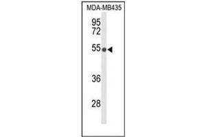 Western blot analysis of DMC1 Antibody (N-term) in MDA-MB435 cell line lysates (35ug/lane). (DMC1 anticorps  (N-Term))