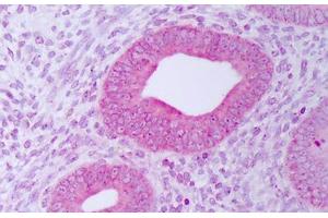 Anti-PDIA3 / ERp57 antibody IHC staining of human uterus, endometrium. (PDIA3 anticorps)