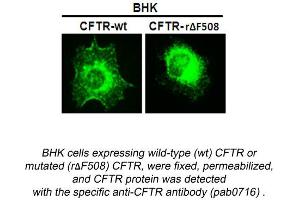Image no. 1 for anti-Cystic Fibrosis Transmembrane Conductance Regulator (ATP-Binding Cassette Sub-Family C, Member 7) (CFTR) (N-Term) antibody (ABIN559719) (CFTR anticorps  (N-Term))