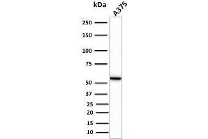 Western Blotting (WB) image for anti-Vimentin (VIM) antibody (ABIN6940885)