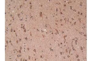 IHC-P analysis of Human Brain Tissue, with DAB staining. (EZH2 anticorps  (AA 51-285))