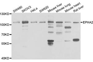 Western blot analysis of extracts of various cell lines, using EPHA2 antibody (ABIN5975494) at 1/1000 dilution. (EPH Receptor A2 anticorps)