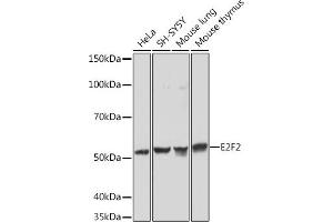 Western blot analysis of extracts of various cell lines, using E2F2 Rabbit mAb (ABIN1680064, ABIN3017656, ABIN3017657 and ABIN7101516) at 1:1000 dilution. (E2F2 anticorps)