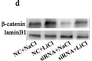 Western Blotting (WB) image for anti-Catenin, beta (CATNB) (AA 661-781) antibody (ABIN738621)