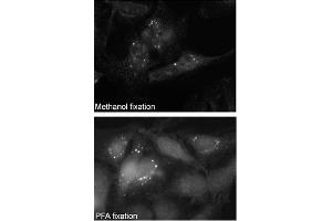 Immunofluorescence (IF) image for anti-Sequestosome 1 (SQSTM1) (AA 317-346) antibody (ABIN388979)