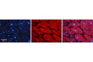 Rabbit Anti-SF3B1 Antibody   Formalin Fixed Paraffin Embedded Tissue: Human heart Tissue Observed Staining: Cytoplasmic Primary Antibody Concentration: 1:100 Other Working Concentrations: 1:600 Secondary Antibody: Donkey anti-Rabbit-Cy3 Secondary Antibody Concentration: 1:200 Magnification: 20X Exposure Time: 0. (SF3B1 anticorps  (N-Term))