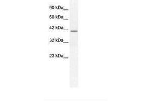 Image no. 1 for anti-Secreted phosphoprotein 1 (SPP1) (C-Term) antibody (ABIN203280) (Osteopontin anticorps  (C-Term))
