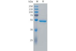 Cynomolgus CA9 Protein, His Tag on SDS-PAGE under reducing condition. (CA9 Protein (AA 38-398) (His tag))