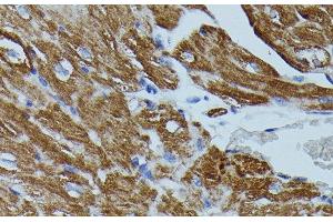 Immunohistochemistry of paraffin-embedded Mouse heart using FKBP1B Polyclonal Antibody at dilution of 1:100 (40x lens). (FKBP1B anticorps)