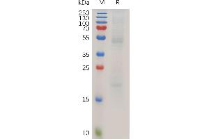 Human RAGE Protein, His Tag on SDS-PAGE under reducing condition. (RAGE Protein (AA 27-340) (His tag))