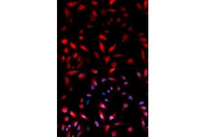 Immunofluorescence (IF) image for anti-Heat Shock 27kDa Protein 1 (HSPB1) (pSer82) antibody (ABIN1870246) (HSP27 anticorps  (pSer82))