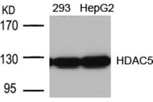 Image no. 1 for anti-Histone Deacetylase 5 (HDAC5) (AA 496-500) antibody (ABIN197341) (HDAC5 anticorps  (AA 496-500))