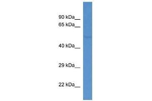 Western Blot showing Fkrp antibody used at a concentration of 1. (FKRP anticorps  (C-Term))