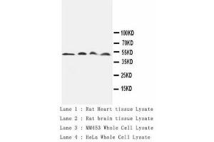 Image no. 1 for anti-Cathepsin D (CTSD) antibody (ABIN1502057) (Cathepsin D anticorps)
