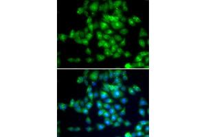 Immunofluorescence analysis of MCF-7 cells using SIRT3 antibody. (SIRT3 anticorps  (C-Term))