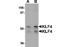 Western Blotting (WB) image for anti-Kruppel-Like Factor 4 (Gut) (KLF4) (C-Term) antibody (ABIN1030469) (KLF4 anticorps  (C-Term))