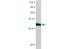 Western Blot detection against Immunogen (36. (OXSR1 anticorps  (AA 351-450))