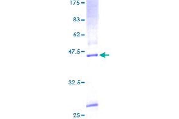 KDELR3 Protein (AA 1-214) (GST tag)