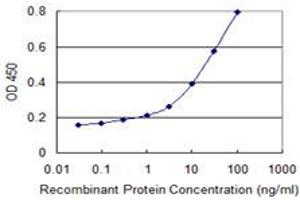 Detection limit for recombinant GST tagged VIL1 is 0. (Villin 1 anticorps  (AA 1-77))