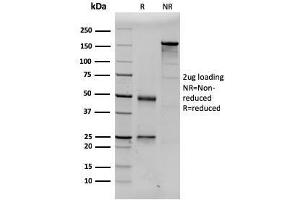 SDS-PAGE Analysis Purified Prolactin Mouse Monoclonal Antibody (PRL/2643). (Prolactin anticorps  (AA 63-201))