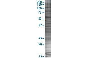 ZHX1 transfected lysate. (ZHX1 293T Cell Transient Overexpression Lysate(Denatured))