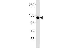 Western blot testing of CSF1R antibodyat 1:4000 dilution + U-87MG lysate; Predicted molecular weight: 106-116 kDa. (CSF1R anticorps)