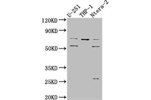 Western Blot Positive WB detected in: U-251 whole cell lysate, THP-1 whole cell lysate, Ntera-2 whole cell lysate All lanes: PTH1R antibody at 1:1000 Secondary Goat polyclonal to rabbit IgG at 1/50000 dilution Predicted band size: 67 kDa Observed band size: 72, 55 kDa (Recombinant PTH1R anticorps)