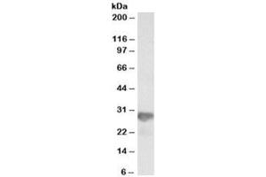 Western blot testing of HeLa lysate with NNMT antibody at 0. (NNMT anticorps)