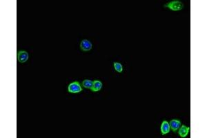 Immunofluorescent analysis of HepG2 cells using ABIN7167280 at dilution of 1:100 and Alexa Fluor 488-congugated AffiniPure Goat Anti-Rabbit IgG(H+L) (RAB28 anticorps  (AA 98-218))