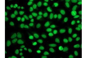 Immunofluorescence (IF) image for anti-Fibroblast Growth Factor Receptor 2 (FGFR2) antibody (ABIN1498250) (FGFR2 anticorps)