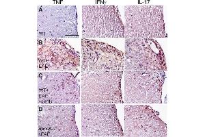 Immunohistochemistry (IHC) image for anti-Interferon gamma (IFNG) (AA 75-155) antibody (ABIN669126)