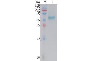 Mouse Nectin-4 Protein, His Tag on SDS-PAGE under reducing condition. (PVRL4 Protein (AA 31-347) (His tag))