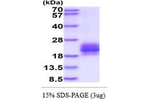 SDS-PAGE (SDS) image for B and T Lymphocyte Associated (BTLA) (AA 31-157) protein (His tag) (ABIN7281321) (BTLA Protein (AA 31-157) (His tag))