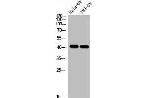 Western blot analysis of HELA-UV 293T-UV using p-Rad51 (T309) antibody. (RAD51 anticorps  (pThr309))