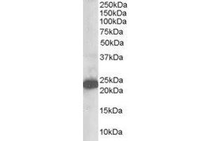 ABIN2560214 staining (1µg/ml) of Human Brain lysate (RIPA buffer, 35µg total protein per lane). (STMN2 anticorps  (N-Term))