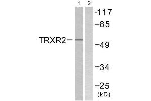 Western Blotting (WB) image for anti-Thioredoxin Reductase 2 (TXNRD2) (C-Term) antibody (ABIN1848862) (TXNRD2 anticorps  (C-Term))