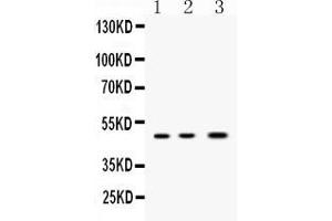 Western blot analysis of Nanog expression in rat ovary extract ( Lane 1), mouse ovary extract ( Lane 2) and MCF-7 whole cell lysates ( Lane 3). (Nanog anticorps  (Middle Region))