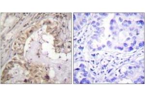 Immunohistochemistry (IHC) image for anti-BCL2-Like 1 (BCL2L1) (AA 13-62) antibody (ABIN2888760) (BCL2L1 anticorps  (AA 13-62))