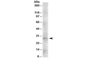 Western blot testing of human heart lysate with DKK2 antibody at 2ug/ml. (DKK2 anticorps)