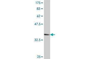 Western Blot detection against Immunogen (37. (SPRYD3 anticorps  (AA 1-100))