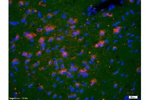 Formalin-fixed and paraffin-embedded rat brain labeled with Anti-TSHR Polyclonal Antibody, Unconjugated (ABIN723470) 1:200, overnight at 4°C, The secondary antibody was Goat Anti-Rabbit IgG, Cy3 conjugated used at 1:200 dilution for 40 minutes at 37°C. (TSH receptor anticorps  (AA 31-100))