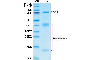 Human GARP(Y137H)&Latent TGF Beta Complex on Tris-Bis PAGE under reduced condition. (GARP & Latent TGF beta 1 Complex (Tyr137His-Mutant) protein (His-Avi Tag))