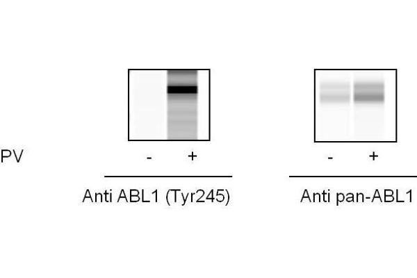 ABL1 Kit ELISA