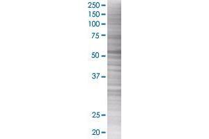 SNX21 transfected lysate. (SNX21 293T Cell Transient Overexpression Lysate(Denatured))