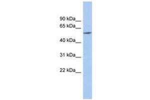 Image no. 1 for anti-Preferentially Expressed Antigen in Melanoma (PRAME) (N-Term) antibody (ABIN6743940) (PRAME anticorps  (N-Term))