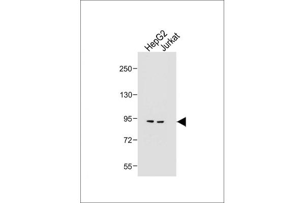 MGAT5 anticorps  (C-Term)