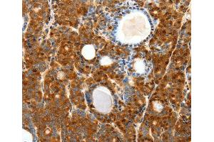 Immunohistochemistry (IHC) image for anti-Secretin Receptor (SCTR) antibody (ABIN3017416) (SCTR anticorps)